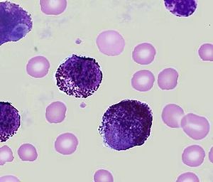 mast cells