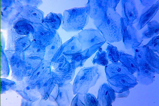 cheek cells stained with methylene blue